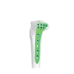 Los fragmentos grandes son implantes ortopédicos diseñados para tratar fracturas de huesos largos como el fémur, tibia y húmero.
Incluyen placas y tornillos de mayor tamaño y resistencia, capaces de soportar el peso corporal y estabilizar fracturas más complejas.